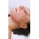 Enterodermalna akupunktura twarzy (połowa twarzy)